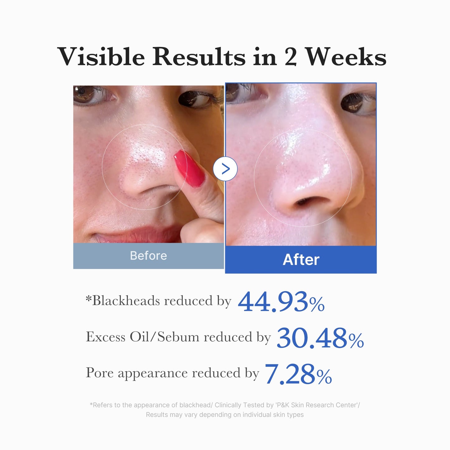Medicube [Subscr.] Zero Pore Pads