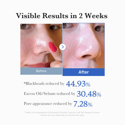 Medicube [Subscr.] Zero Pore Pads