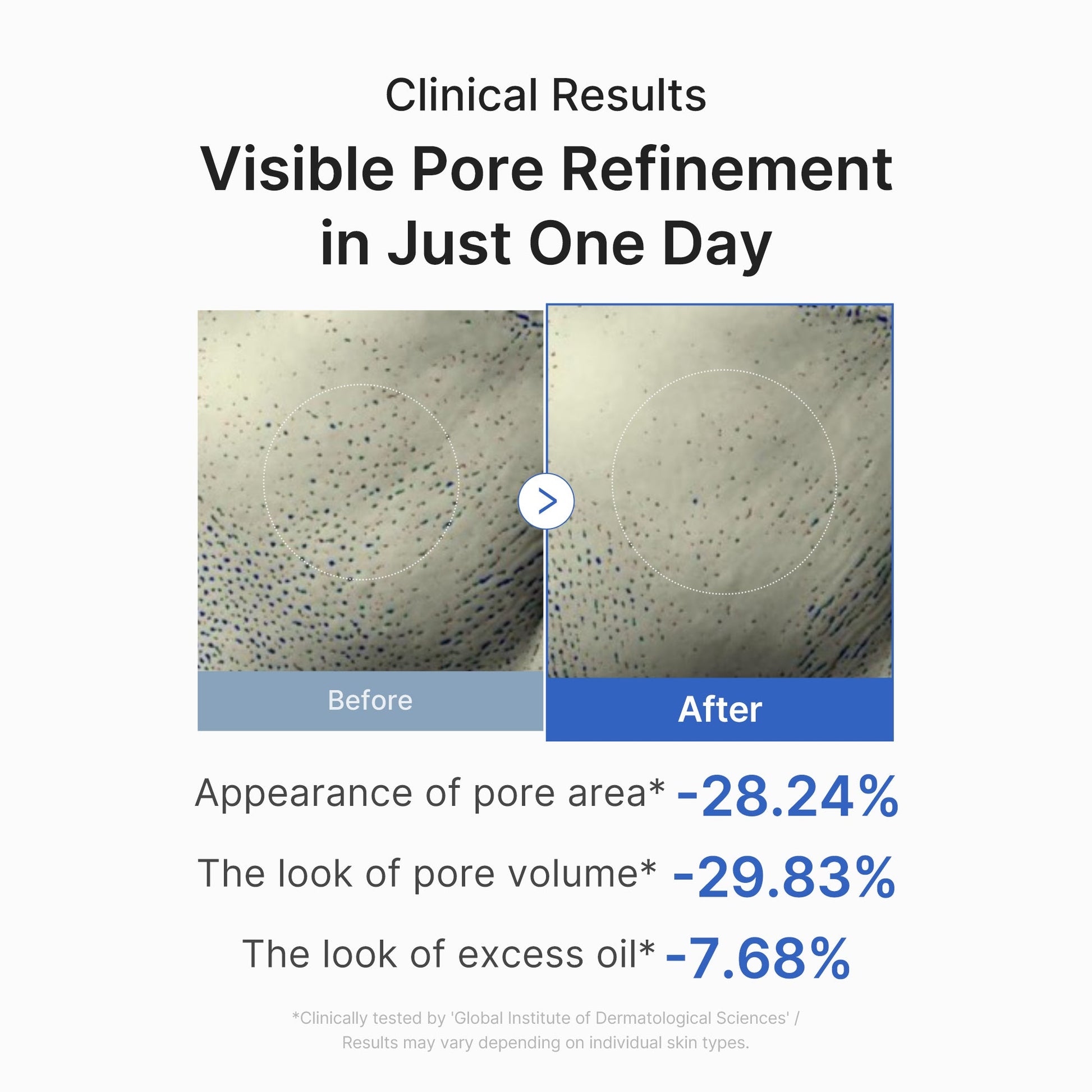 Medicube [Subscr.] Zero Pore One-day Peptide Serum