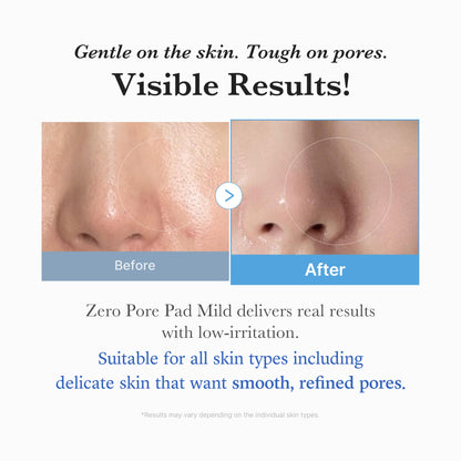 Medicube [Subscr.] Zero Pore Madecassoside Pads (Mild)