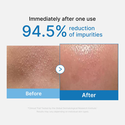 Medicube Zero Pore Blackhead Deep Cleansing Oil