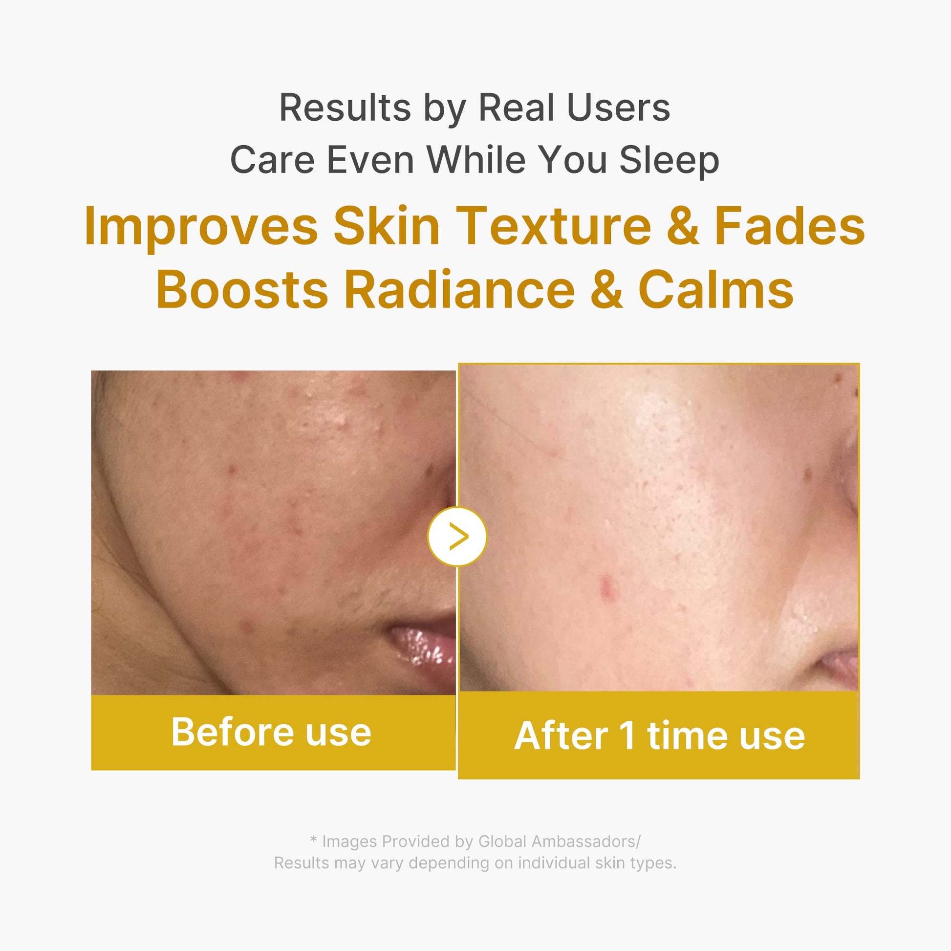 Medicube Kojic Acid Turmeric Overnight Wrapping Mask
