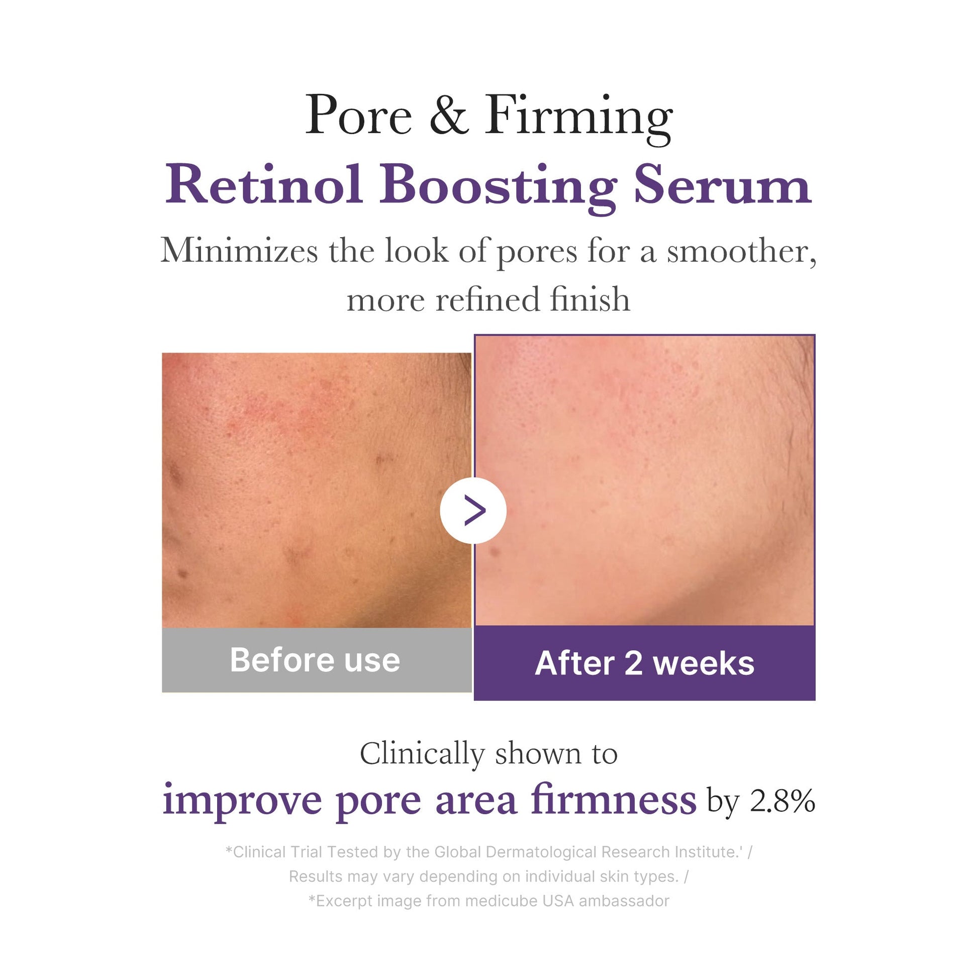 Medicube [Subscr.] Retinol NMN Boosting Serum