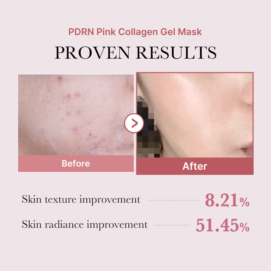 Medicube [Subscr.] Salmon PDRN Pink Collagen Jelly Gel Mask