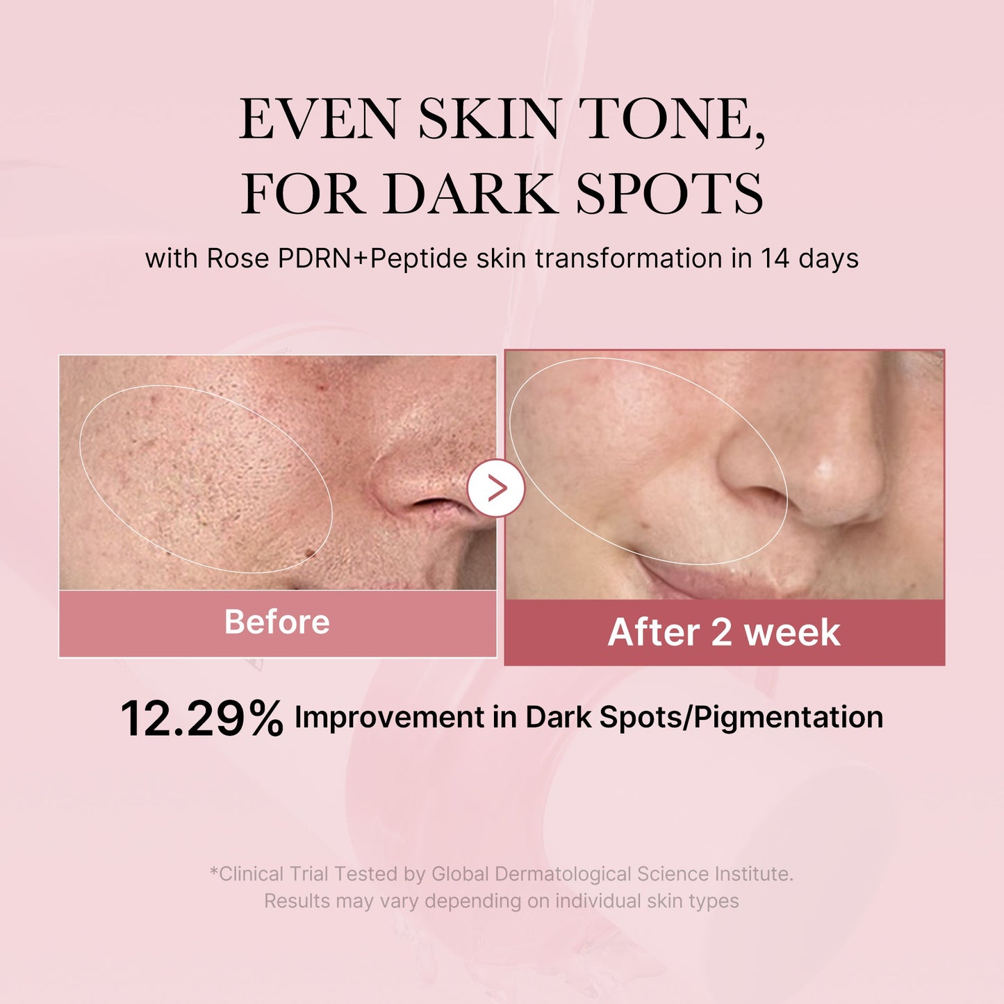 Medicube [Subscr.] PDRN Pink Peptide Toner