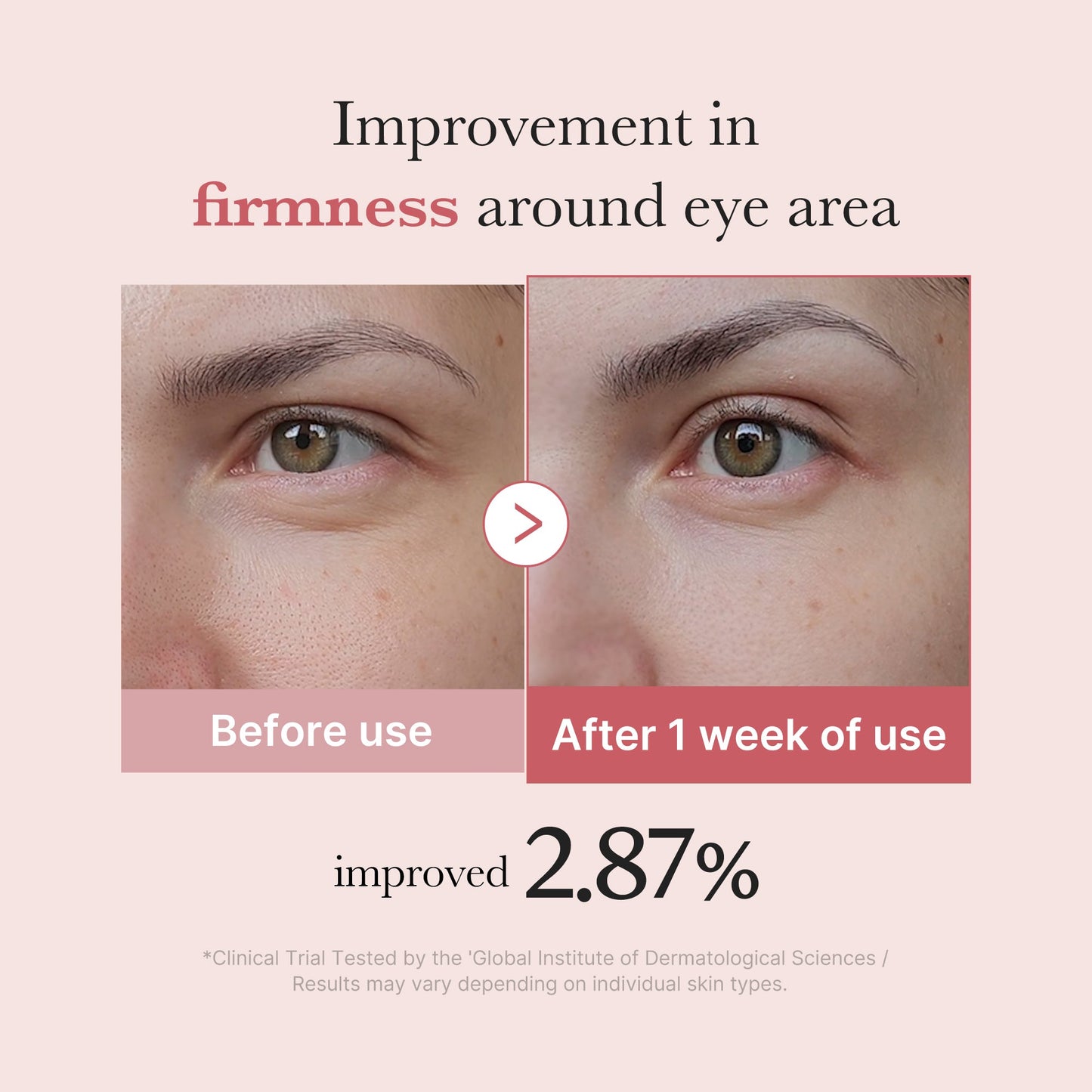 Medicube [Subscr.] PDRN Pink Peptide Eye Cream