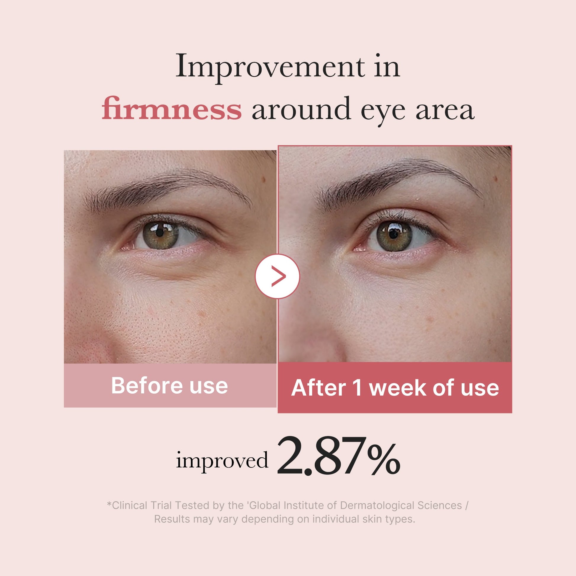 Medicube [Subscr.] PDRN Pink Peptide Eye Cream