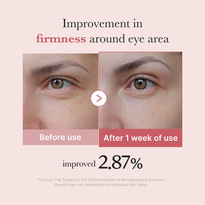 Medicube [Subscr.] PDRN Pink Peptide Eye Cream