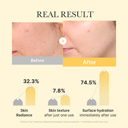 Medicube [Subscr.] Kojic Acid Turmeric Gold Jelly Gel Mask