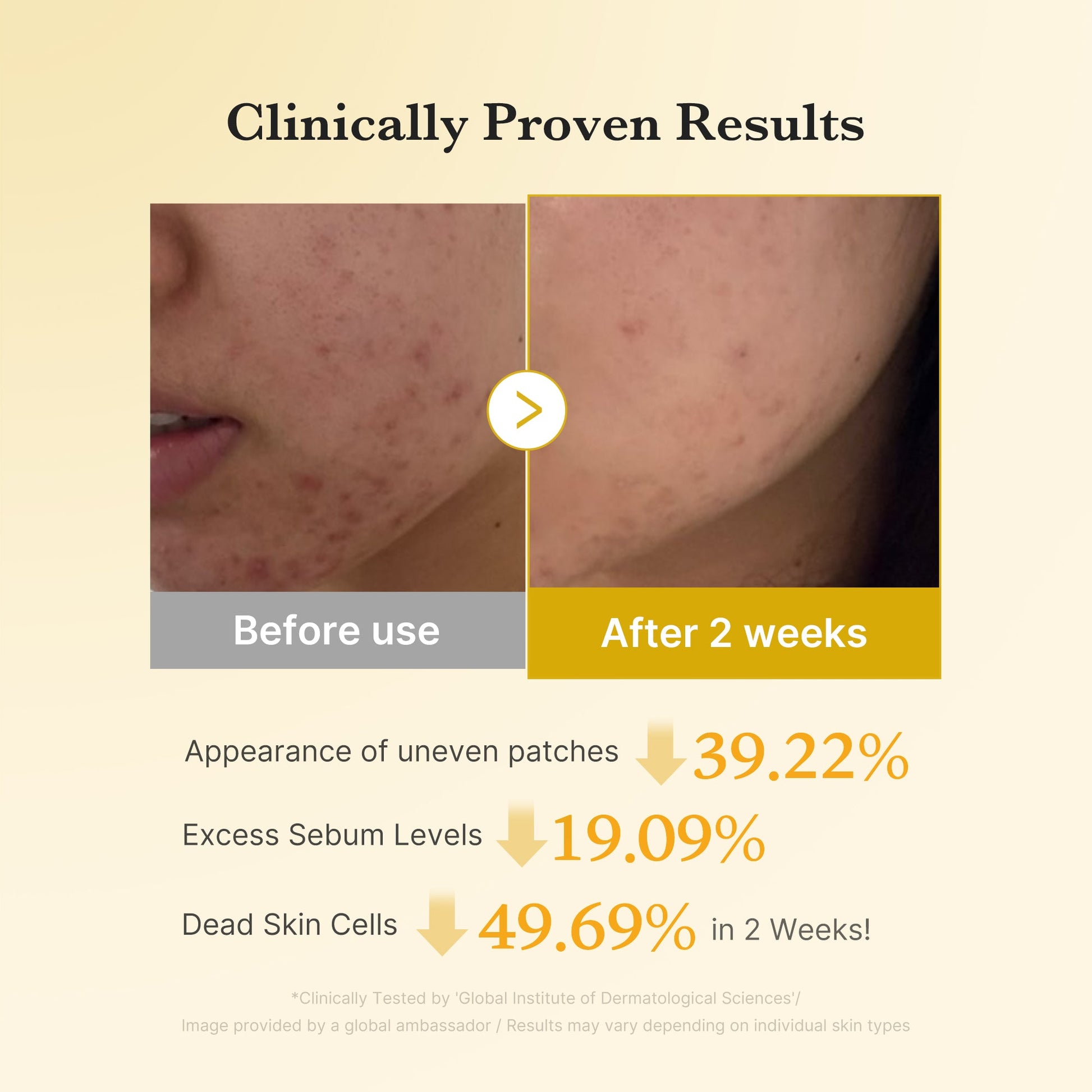 Medicube [Subscr.] Kojic Acid Tumeric Toner Pad