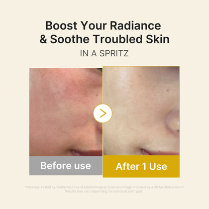 Medicube Kojic Acid Turmeric Vitamin Gold Jelly Mist Serum