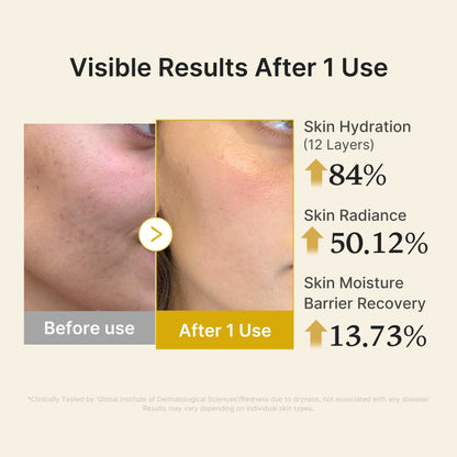 Medicube Kojic Acid Turmeric Vitamin Gold Jelly Mist Serum
