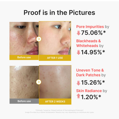 Medicube Kojic Acid Turmeric Peel Shot