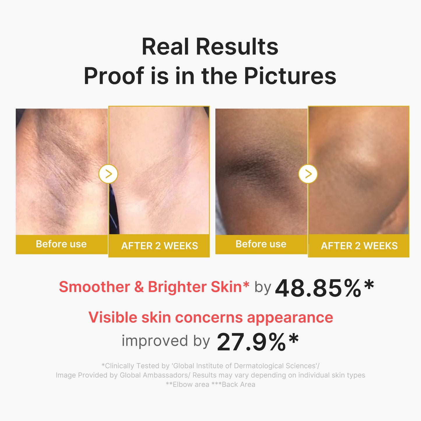 Medicube Kojic Acid Turmeric Body Peel Shot