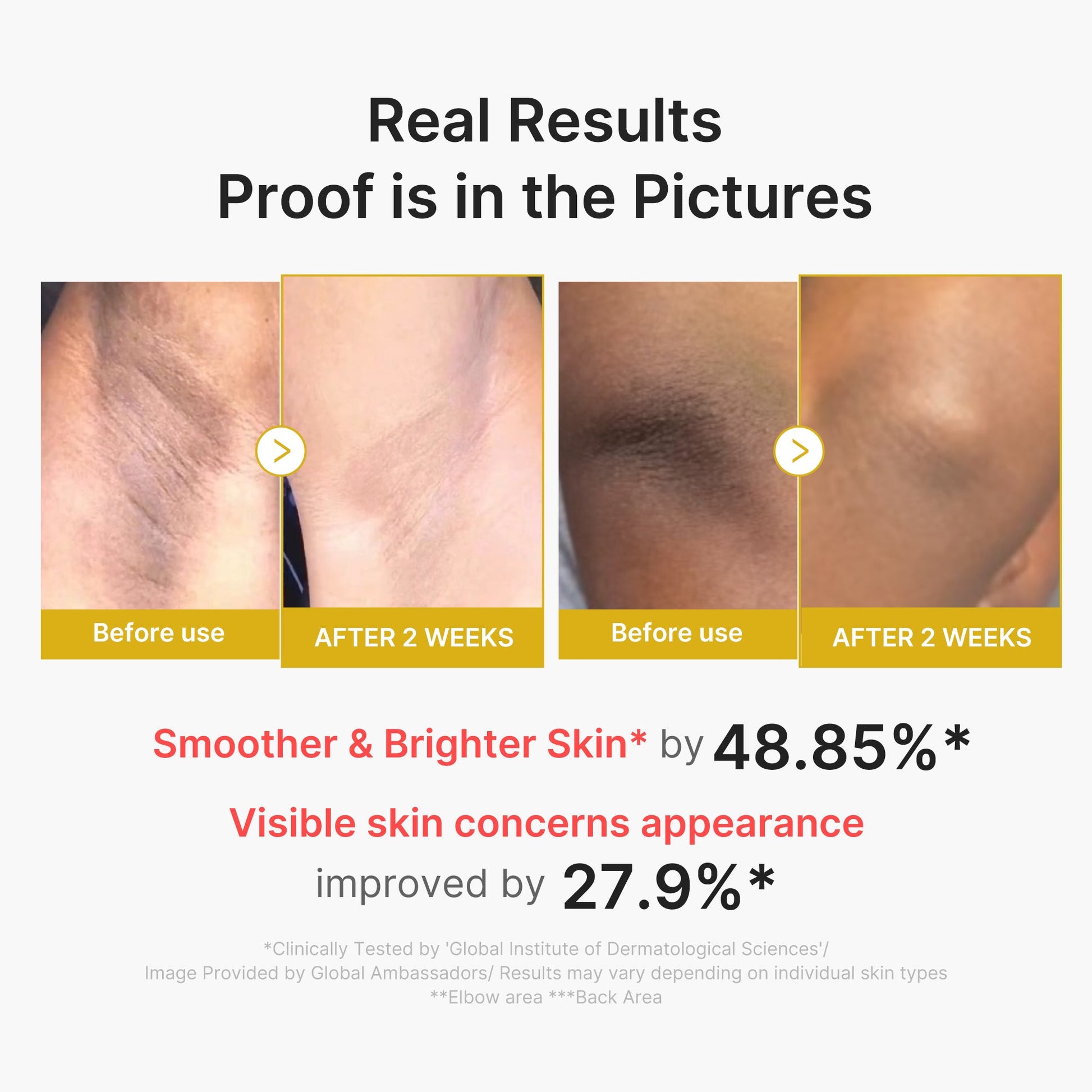 Medicube Kojic Acid Turmeric Body Peel Shot